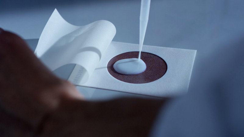 Analisi Campione Di Latte